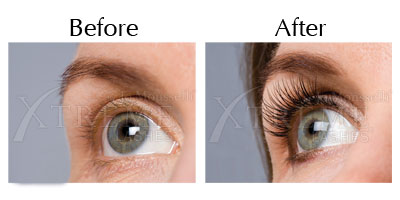 Eyelash extensions photo