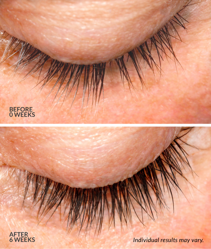 A "before and after" close-up of an eye. The top image, labeled "BEFORE 0 WEEKS," shows a person's eyelashes before treatment. The bottom image, labeled "AFTER 6 WEEKS," shows the same eye with significantly longer, fuller, and darker lashes.