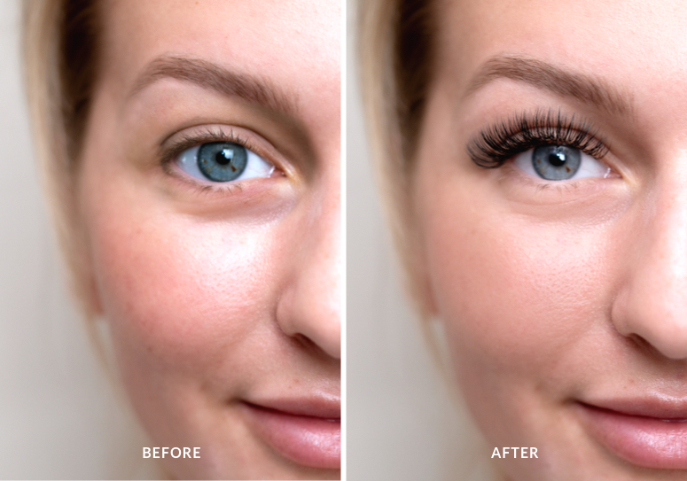 flashcure before and after image