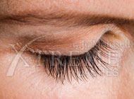 After Eyelash Extensions
